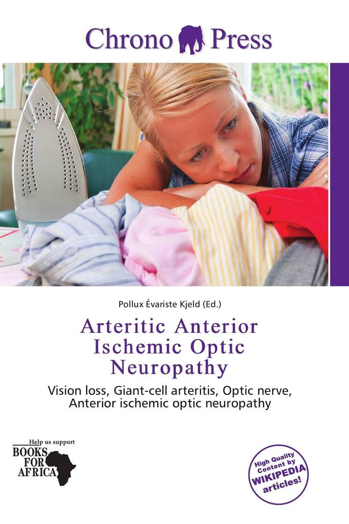 Arteritic Anterior Ischemic Optic Neuropathy