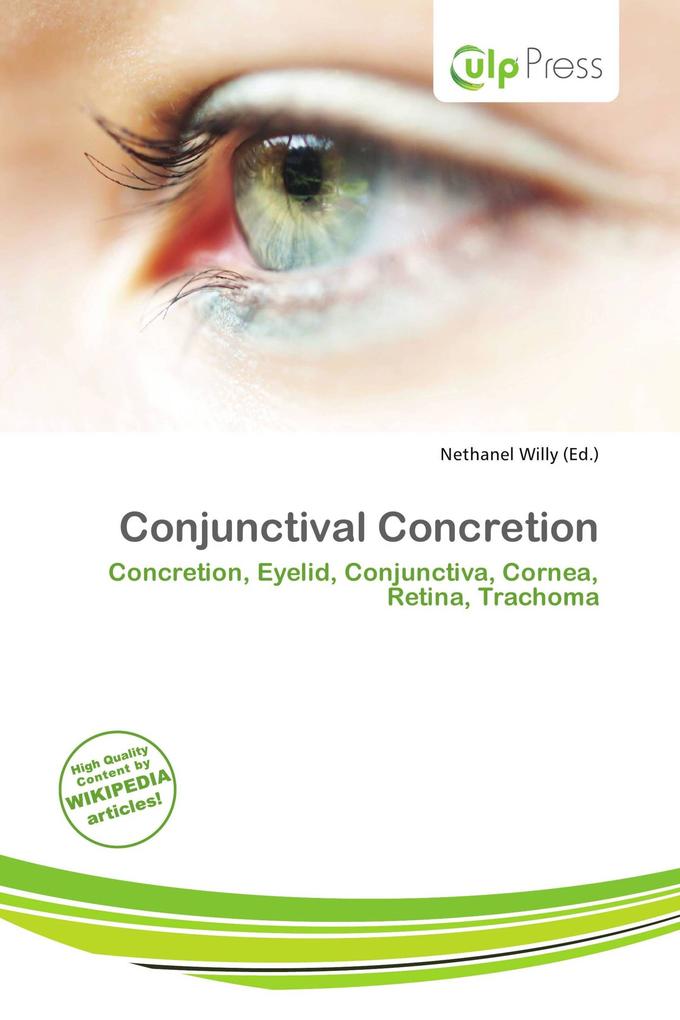 Conjunctival Concretion