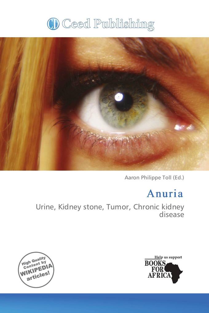 Anuria