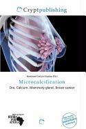 Microcalcification