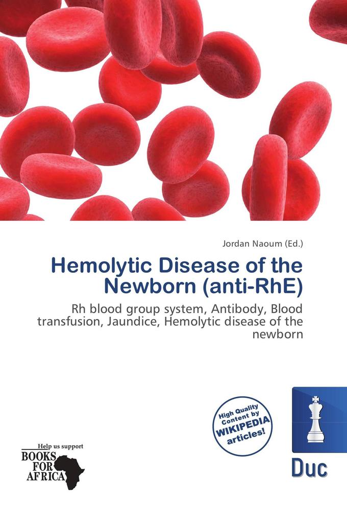 Hemolytic Disease of the Newborn (anti-RhE)