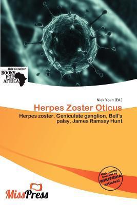 Herpes Zoster Oticus