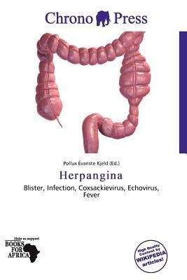 Herpangina