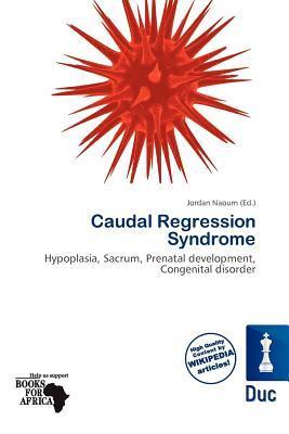 Caudal Regression Syndrome