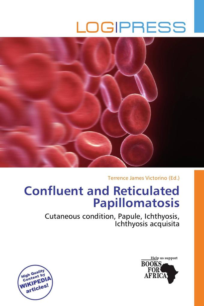 Confluent and Reticulated Papillomatosis