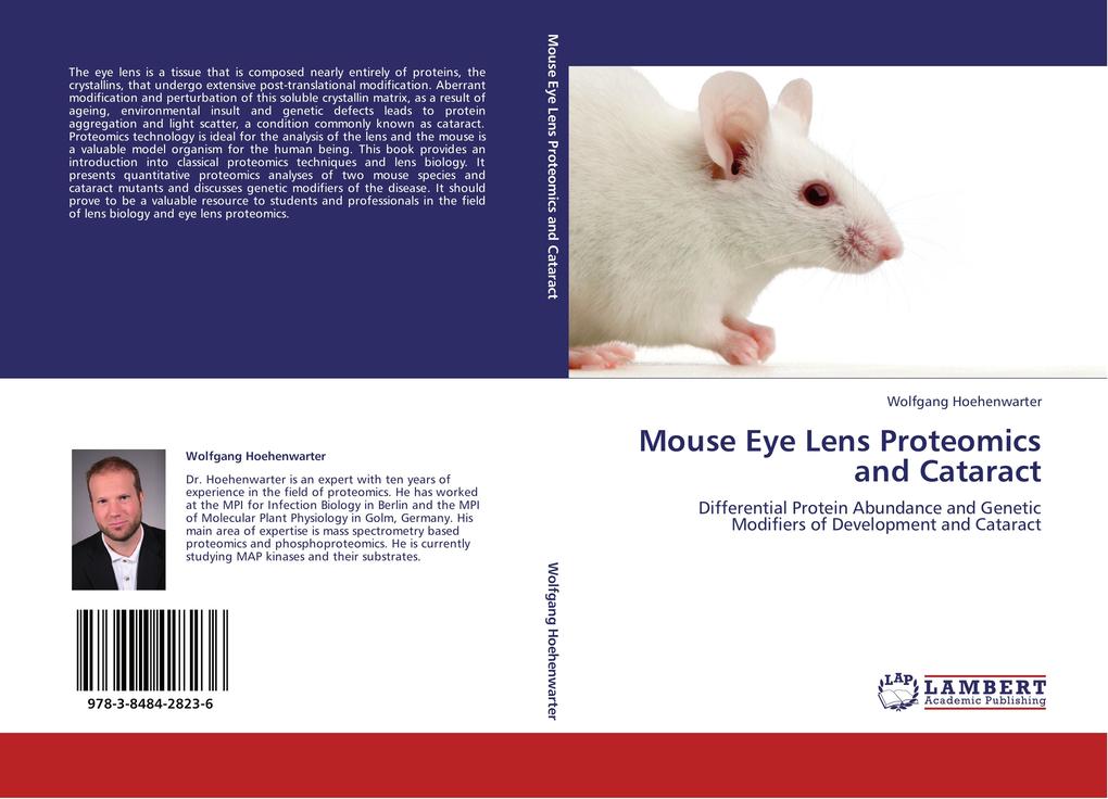 Mouse Eye Lens Proteomics and Cataract