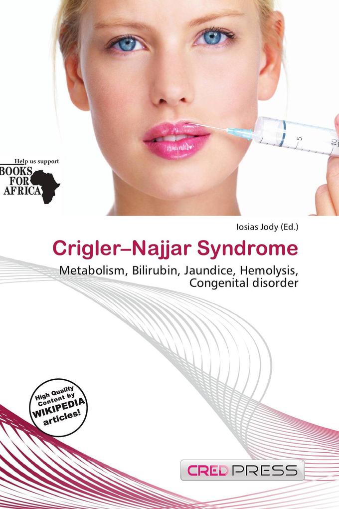 Crigler-Najjar Syndrome