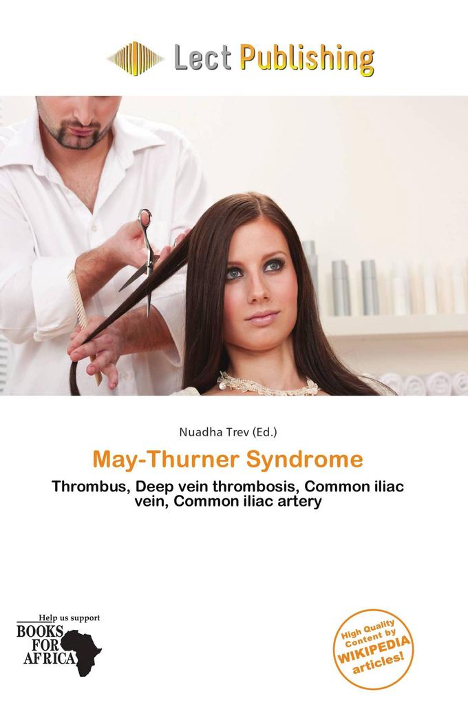 May-Thurner Syndrome
