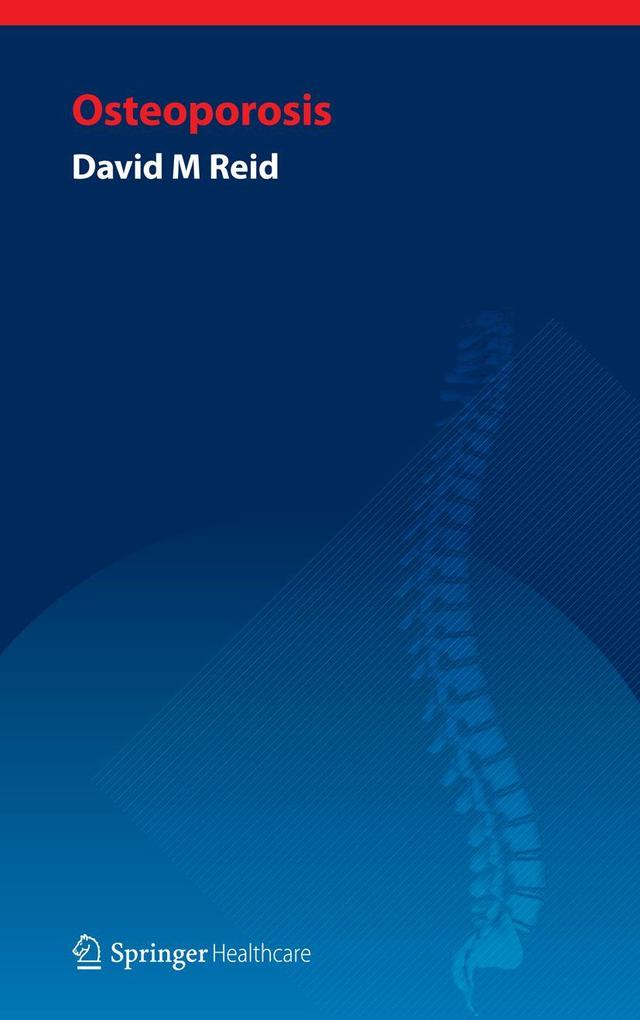 Handbook of Osteoporosis