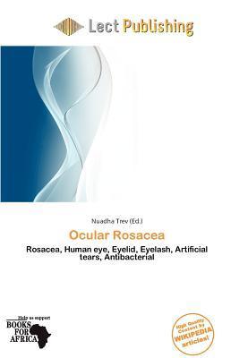Ocular Rosacea