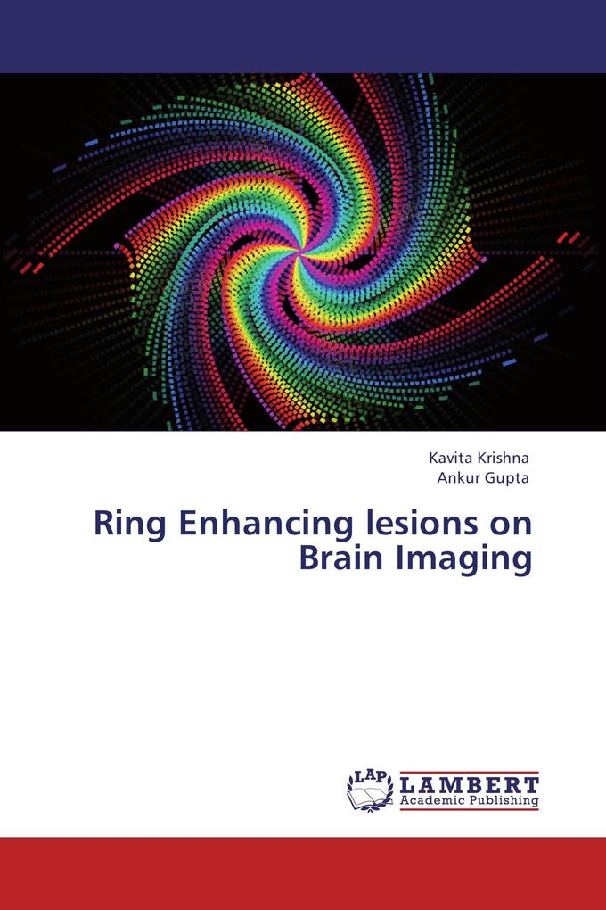 Ring Enhancing lesions on Brain Imaging