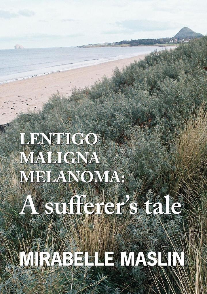 Lentigo Maligna Melanoma
