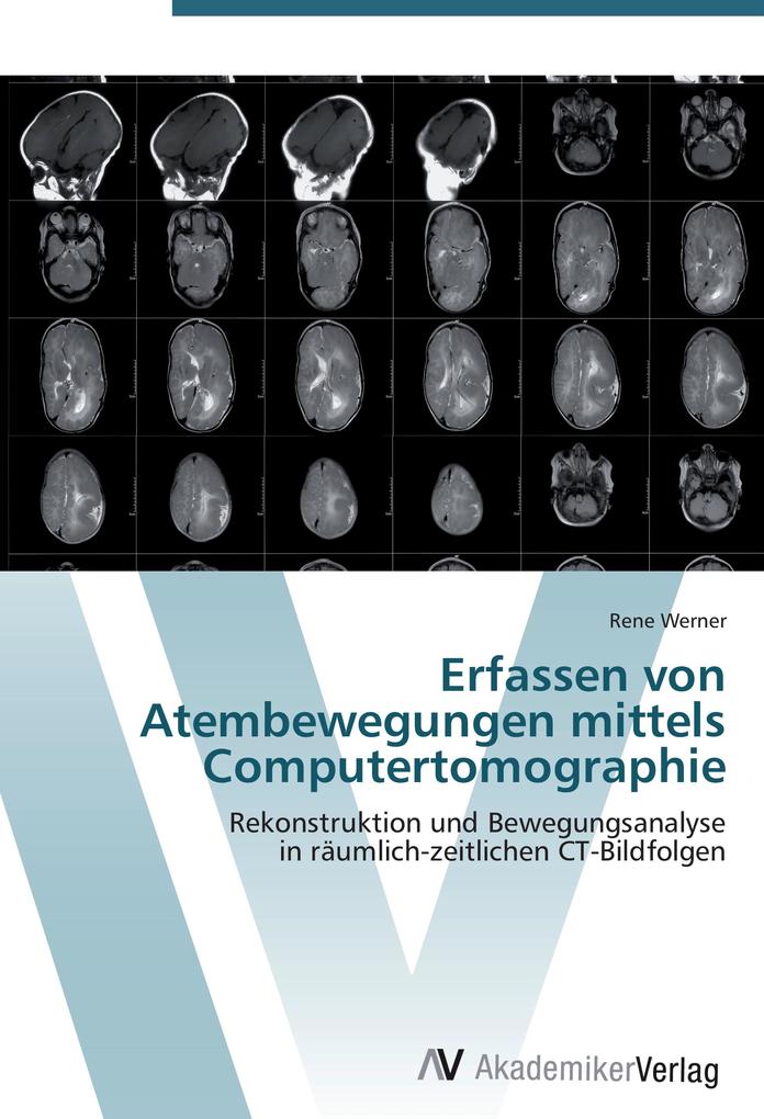 Erfassen von Atembewegungen mittels Computertomographie