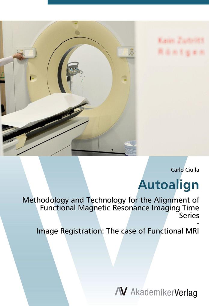 Autoalign