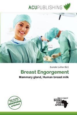 Breast Engorgement