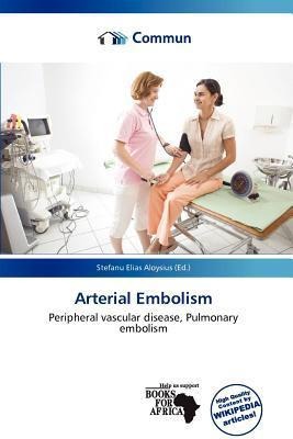 Arterial Embolism