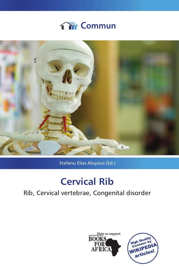 Cervical Rib