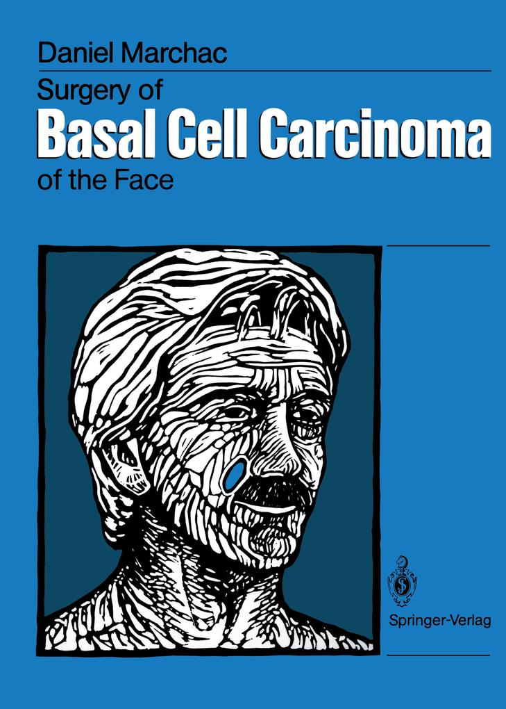Surgery of Basal Cell Carcinoma of the Face