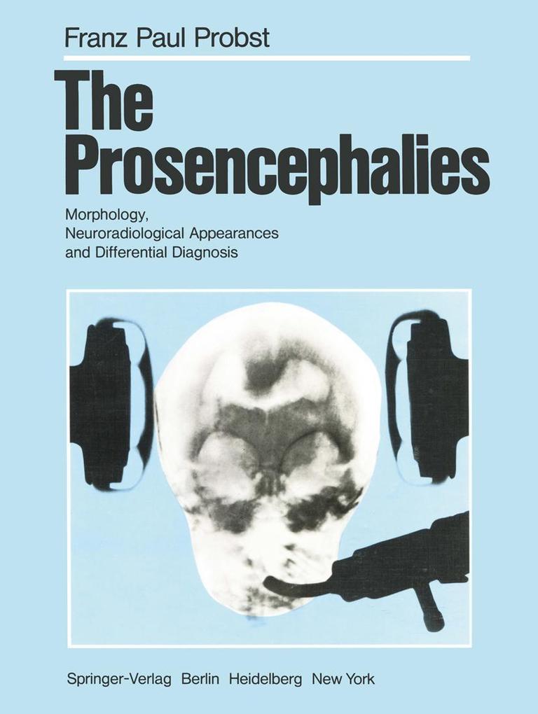 The Prosencephalies