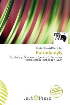 Ectrodactyly