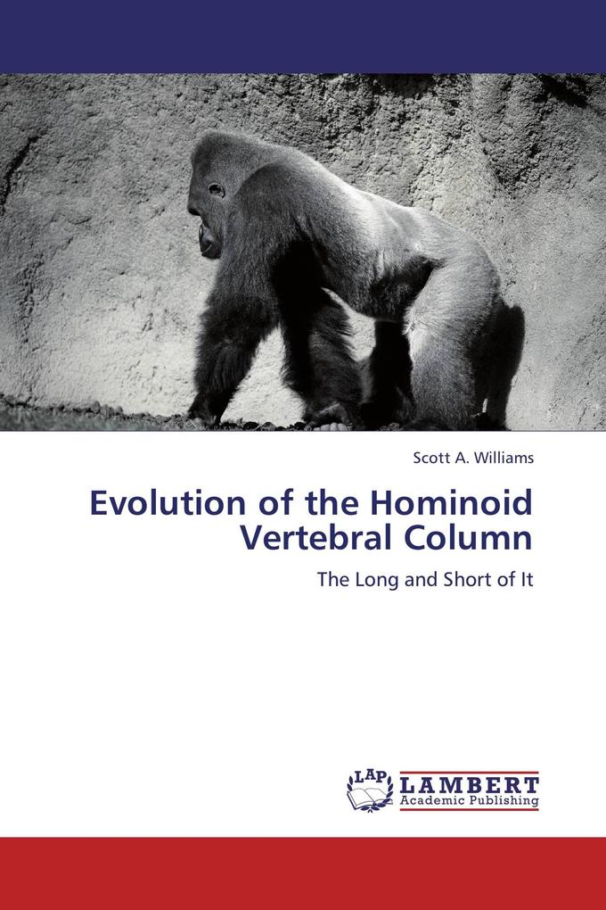Evolution of the Hominoid Vertebral Column