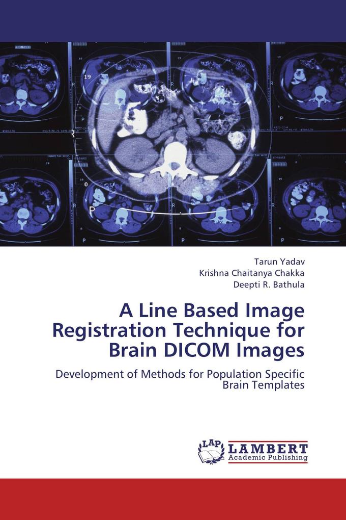 A Line Based Image Registration Technique for Brain DICOM Images