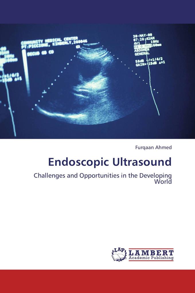 Endoscopic Ultrasound
