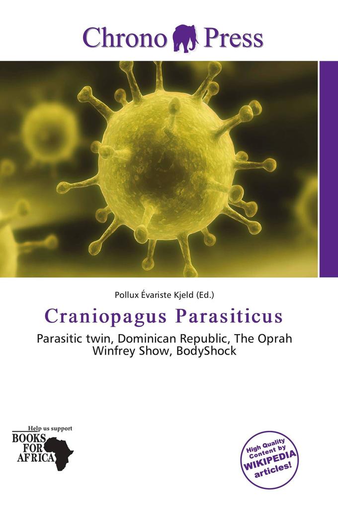 Craniopagus Parasiticus