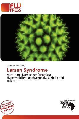Larsen Syndrome