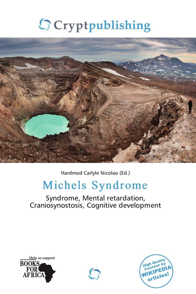 Michels Syndrome