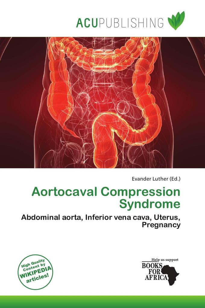 Aortocaval Compression Syndrome