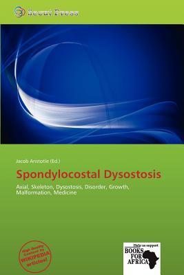 Spondylocostal Dysostosis