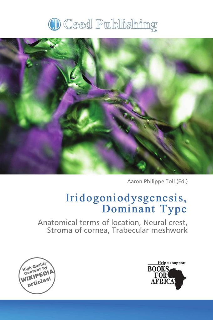 Iridogoniodysgenesis Dominant Type