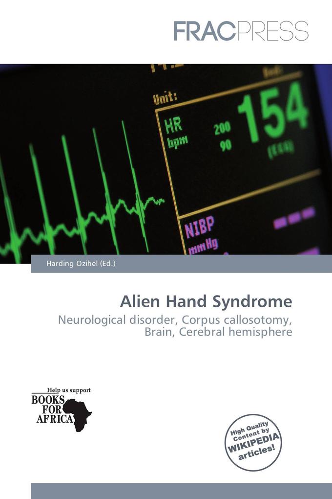 Alien Hand Syndrome