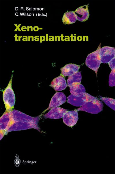Xenotransplantation