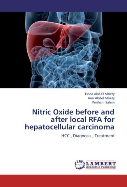 Nitric Oxide before and after local RFA for hepatocellular carcinoma