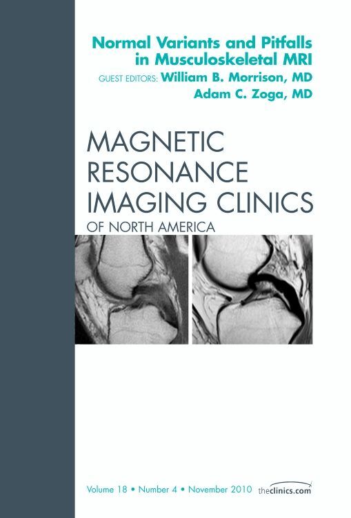 Normal Variants and Pitfalls in Musculoskeletal MRI An Issue of Magnetic Resonance Imaging Clinics