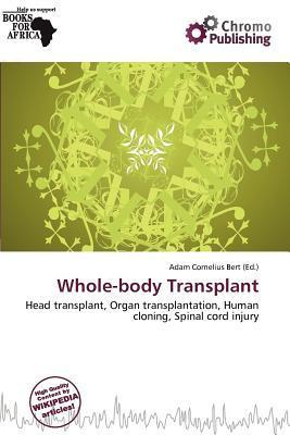 Whole-body Transplant