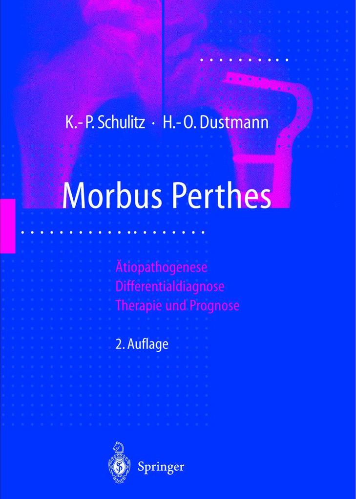 Morbus Perthes