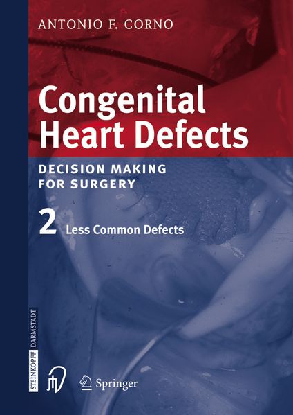 Congenital Heart Defects