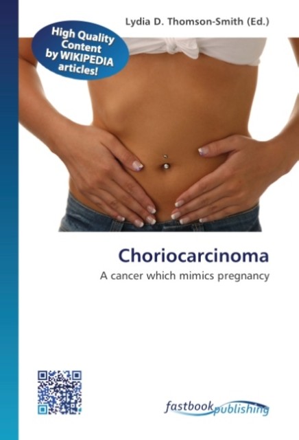 Choriocarcinoma