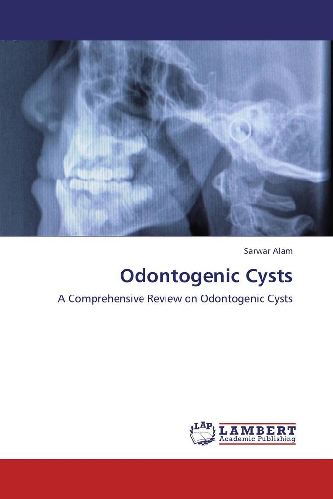 Odontogenic Cysts