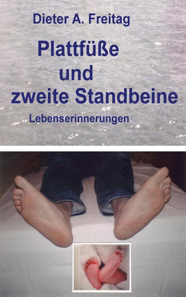 Plattfüße und zweite Standbeine - Dieter A. Freitag