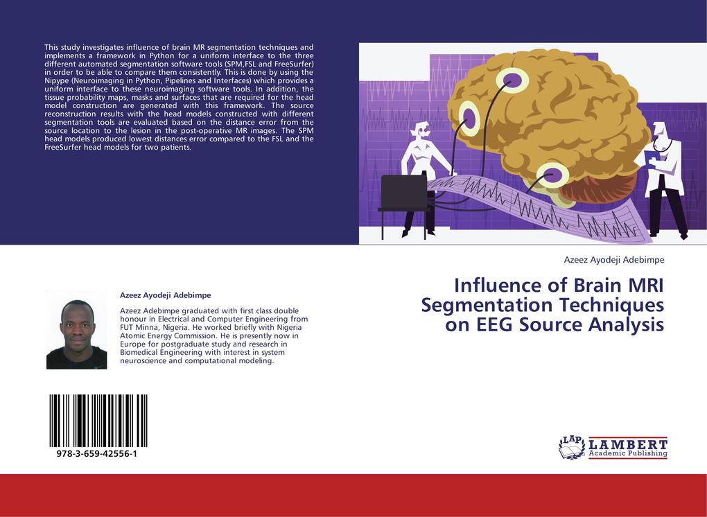 Influence of Brain MRI Segmentation Techniques on EEG Source Analysis
