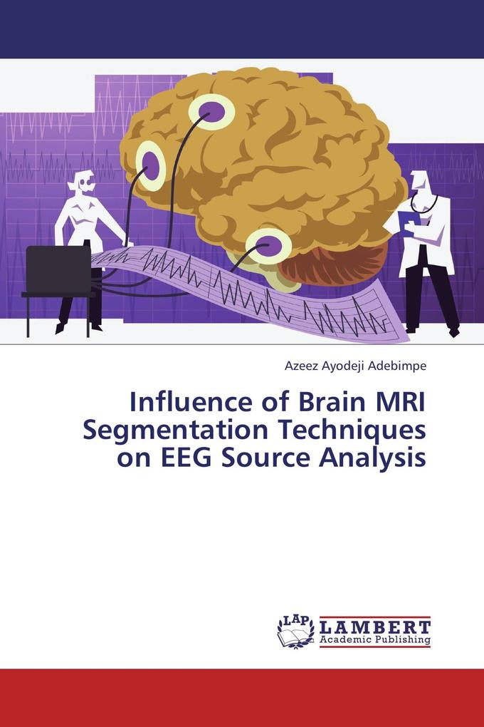 Influence of Brain MRI Segmentation Techniques on EEG Source Analysis