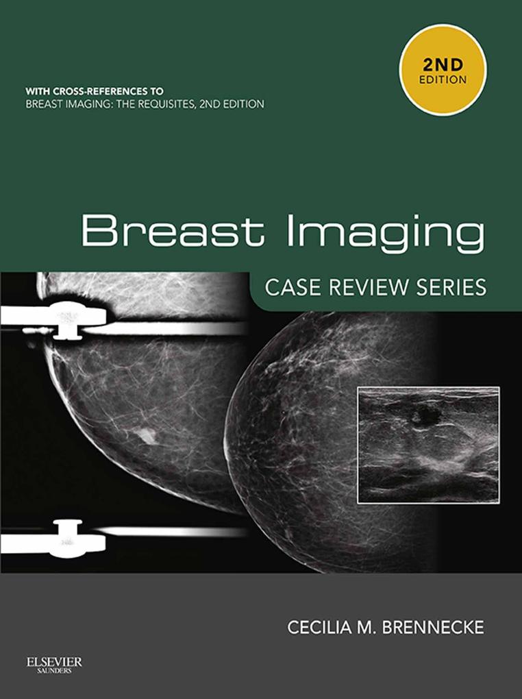 Breast Imaging: Case Review Series E-Book