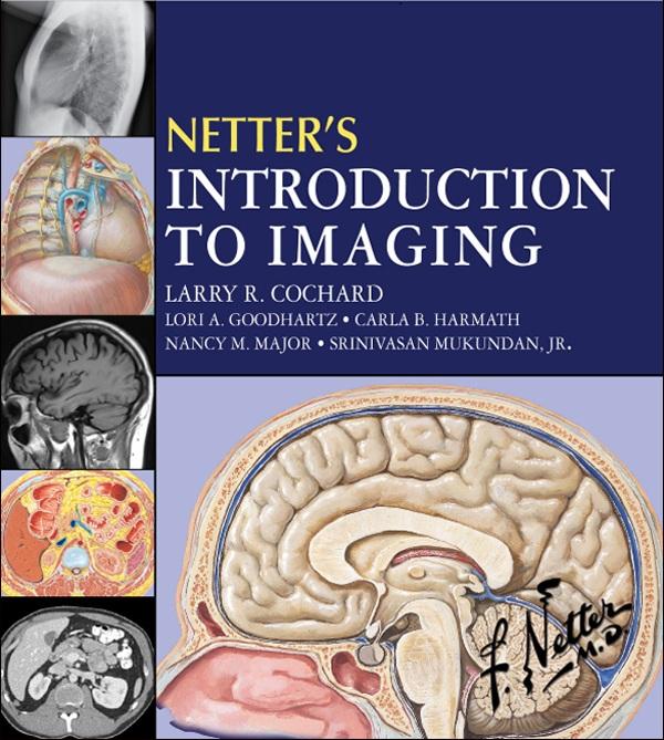 Netter‘s Introduction to Imaging E-Book