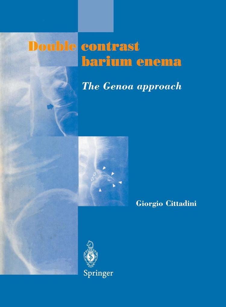Double contrast barium enema