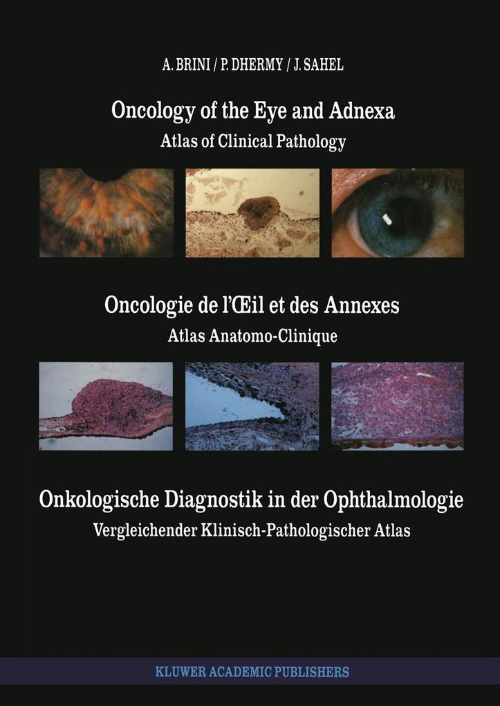 Oncology of the Eye and Adnexa / Oncologie de l'il et des Annexes / Onkologische Diagnostik in der Ophthalmologie