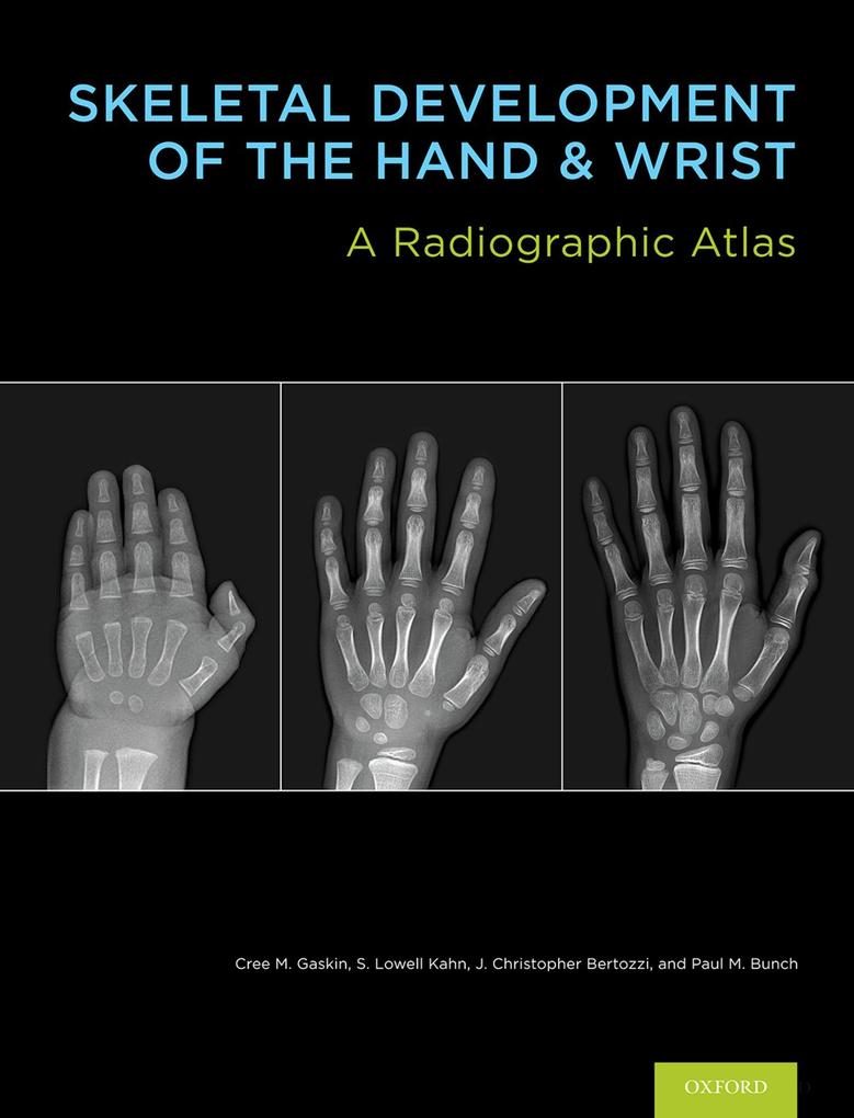 Skeletal Development of the Hand and Wrist - Cree M. Gaskin/ S. Lowell Kahn/ J. Christoper Bertozzi/ Paul M. Bunch